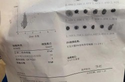 少量dna倍体异常1 2个，可见少量dna倍体异常细胞1-2个