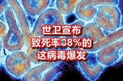 非洲新病毒的最新消息，新病毒的最新消息