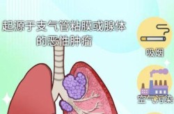 周围型肺ca治愈几率，周围型肺ca是几期