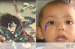 歌舞伎综合症真的漂亮吗，歌舞伎综合症宝宝照片
