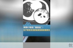 常州最新新型肺炎疫情（2020新型肺炎症状）