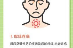 喉咙痒是新型肺炎的症状吗，喉咙痒干咳是肺炎吗