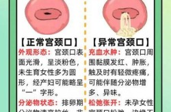 怎么判断女性有没有性疾病，如何检查自己有没有性疾病