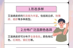 感染7天的症状有哪些，感染艾滋病7天内会有症状吗