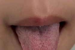 7岁孩子新冠病毒感染症状，小孩子新冠病毒初期症状