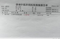 新病毒确诊坐过的凳子，坐过乙肝病毒的凳子