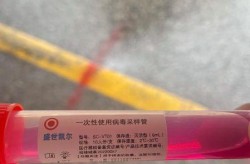 疫情会不会在西安爆发，今年的疫情还会爆发吗
