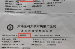 大连又发现2例确诊病例，大连确诊病例