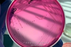 病毒细胞培养的三种类型，病毒培养三种方法
