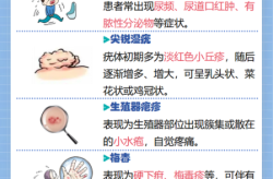 怎么知道有没有传染病，怎么看一个人有没有性疾病