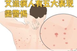 近期病毒感染有哪些症状，病毒感染全身5种症状