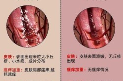 最近病毒感染的症状和表现，最近病毒感染的症状有哪些
