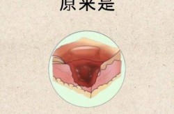 二次阳咳嗽多久才能好，二阳咳嗽一般几天能好
