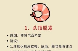 掉发脱发严重是什么原因，掉发脱发严重吃什么药
