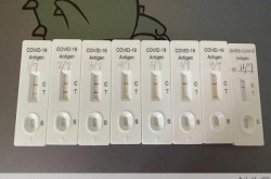 感染新冠20天还没转阴，新冠9天还没转阴正常吗