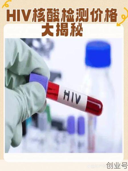 坐火车需要核酸检测吗（核酸检测hiv有没有意义）