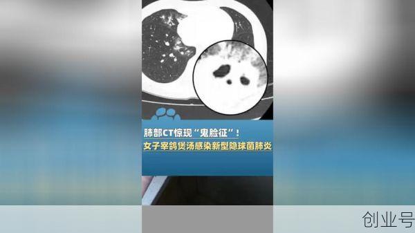 常州最新新型肺炎疫情（2020新型肺炎症状）