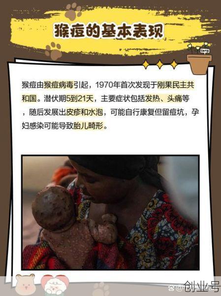 英国猴痘病例已增至57例了吗，猴痘病例为何激增