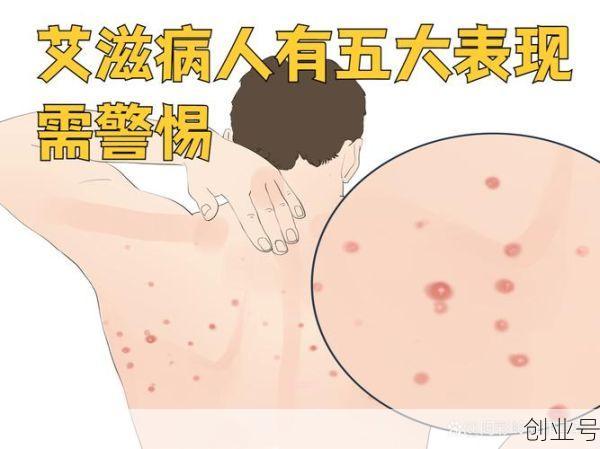 近期病毒感染有哪些症状,病毒感染全身5种症状