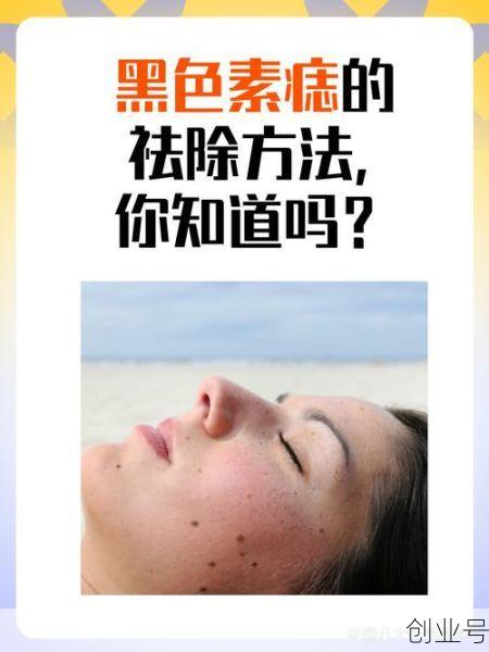 黑色素痣有必要切除吗,黑色素痣切除的利弊