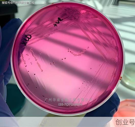 病毒细胞培养的三种类型，病毒培养三种方法