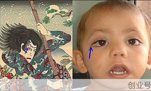 歌舞伎综合症真的漂亮吗,歌舞伎综合症宝宝照片
