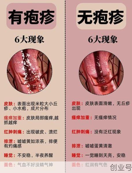 最近病毒感染的症状和表现，最近病毒感染的症状有哪些
