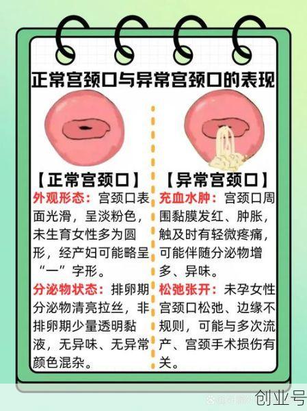 怎么判断女性有没有性疾病，如何检查自己有没有性疾病