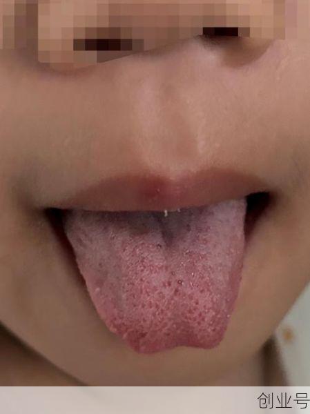 7岁孩子新冠病毒感染症状，小孩子新冠病毒初期症状