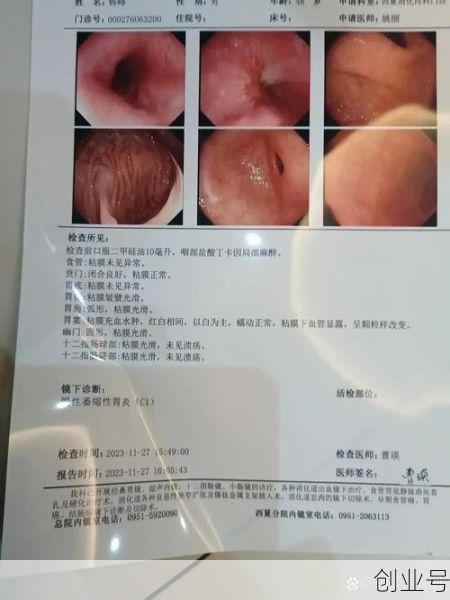 治疗胃食管反流权威医院，胃食管反流最好的医院